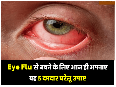Eye Flu इन्फेक्शन से बचने के 5 घरेलू उपाय